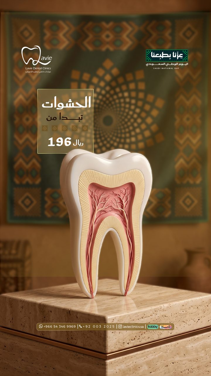 Cosmetic Tooth-Colored Composite Fillings in Riyadh